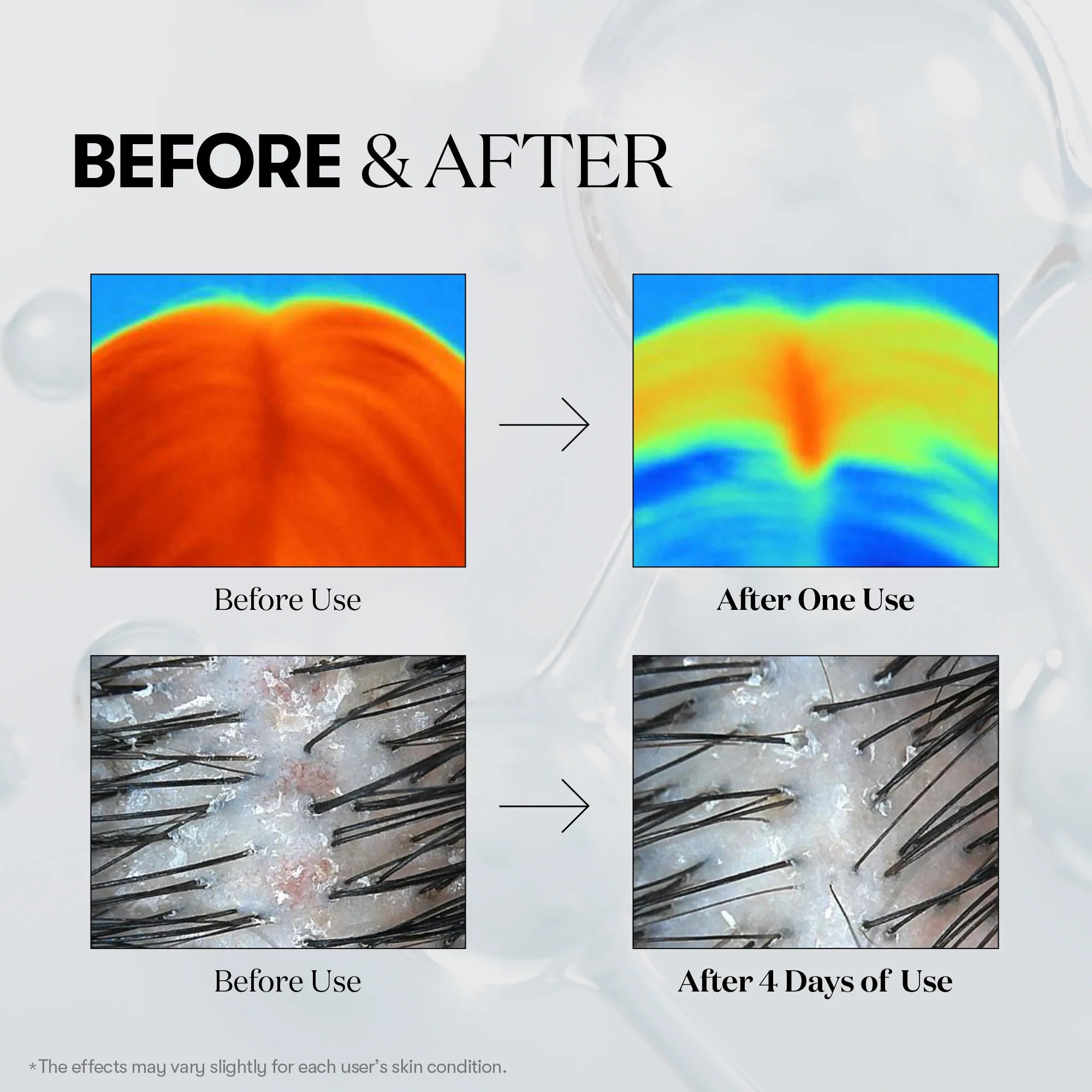 VT PDRN Reedle Shot Hair Ampoule 700dL 15ml