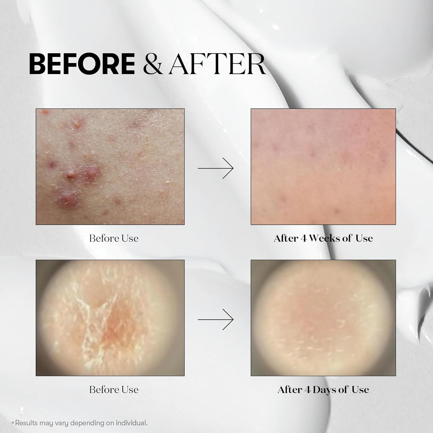 VT Reedle Shot 100 Stick Pouch 2ml x 10EA